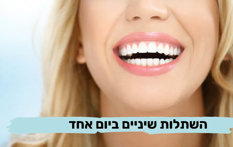 השתלות שיניים ביום אחד